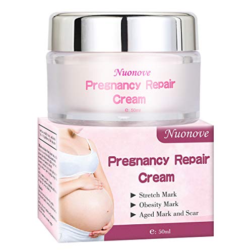 Stretch Marks Cream, Dehnungsstreifen Entfernung Creme, Narbencreme Entfernung Creme (50g)