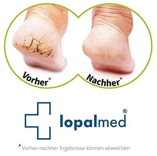 Hornhautentferner und Nagelhautentferner Lopalmed Lösung sehr schnell und stark