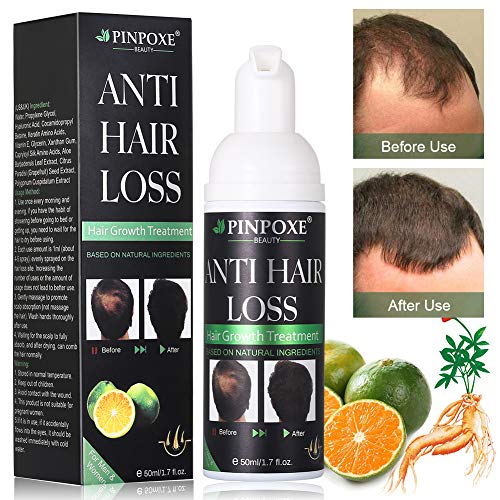 Haarwachstums, Anti Haarausfall, Haarserum,natürliche Kräuteressenz, Haar Faser für Männern und Frauen schnelles Haarwachstum, stärkt Haarwurzeln und fügt natürlichen Glanz 50ml