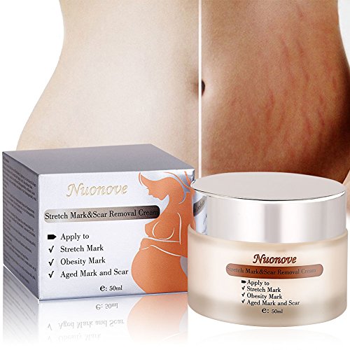 Stretch Marks Cream Narbencreme, Dehnungsstreifen Entfernung Creme, Körper Reparatur Creme Dehnungsstreifen Reparatur Körper Haut Moisturzing für Frauen nach Schwangerschaft, Behandeln Sie Dehnungsstreifen und Narben für Frauen und Männer 50g